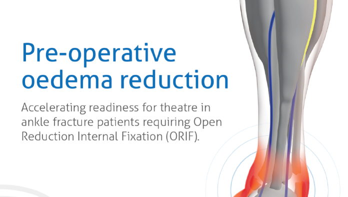 Firstkind Ltd geko® Pre-operative oedema reduction brochure image Firstkind Ltd geko® Pre-operative oedema reduction brochure