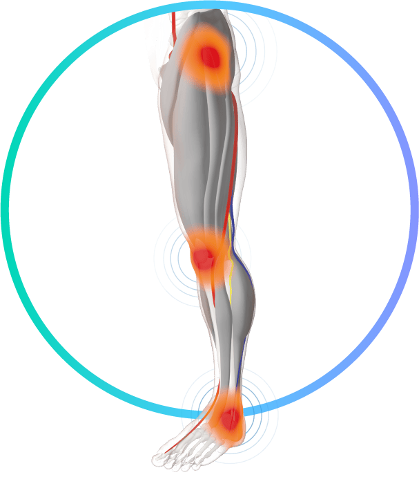 Reducing post-operative & trauma-based oedema
